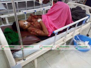 সিজারের ৫ মাস পর পেট থেকে বের হলো গজ