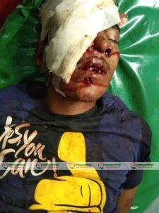 পাটগ্রামে মোটরসাইকেল সংঘর্ষে আহত ০৩