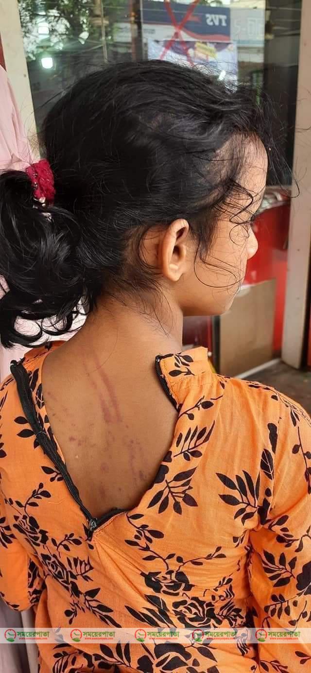 পড়া না পারায় মাগুরায় এক মাদ্রাসা ছাত্রীকে পিটিয়ে আহত।