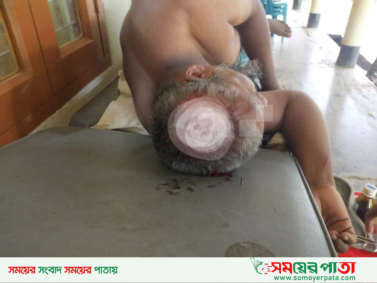বরকলের ভুষণছড়াতে জমি দখলের জের ধরে বিএনপি নেতার হামলায় মারাত্মক আহত দুই
