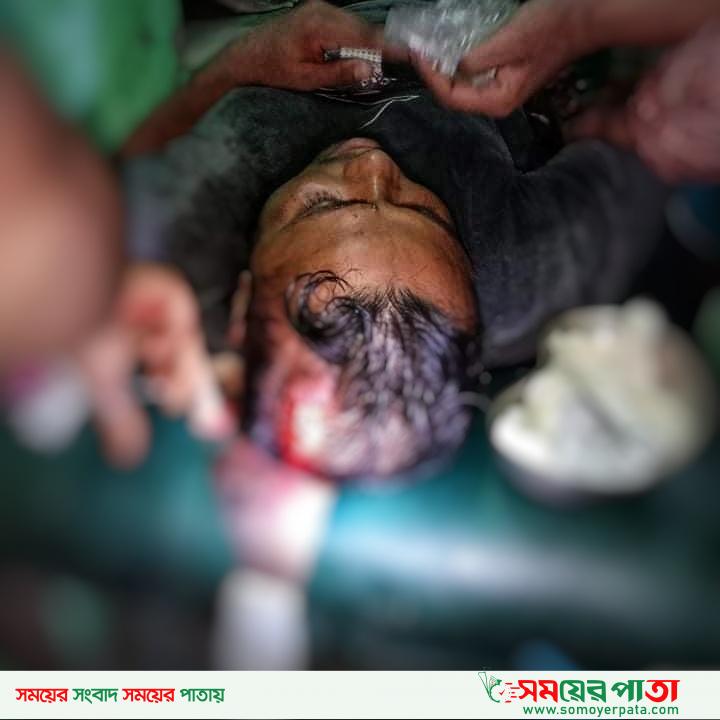 কয়রায় ছাএলীগ নেতার উপর হামলা, অবস্থা আশংকা জনক।