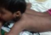 সেই নির্যাতিত শিশুর পাশে জাতীয় মানবাধিকার কমিশন সেই নির্যাতিত শিশুর পাশে জাতীয় মানবাধিকার কমিশন