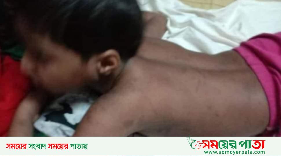 সেই নির্যাতিত শিশুর পাশে জাতীয় মানবাধিকার কমিশন